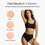 Ulike Air 10 Pro IPL Hair Removal Device - Image 5