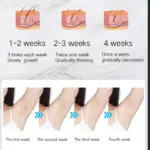 Xiaomi IPL Epilator - Image 5