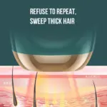 Xiaomi IPL Epilator - Image 4