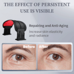 Monivi LED Beauty Mask - Image 3