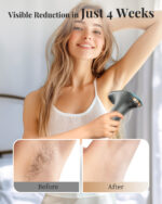 Haarlosy IPL Laser Hair Removal Device - Image 5