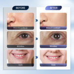 LumaPulse Hydrating LED Halo – 2-in-1 Skincare Innovation - Image 5