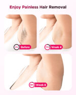 Haarlosy KA10 IPL Hair Removal Device - Image 5