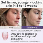 iRestore Illumina LED Mask - Image 6