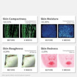 HIME SAMA LED Face Light Therapy Mask – Miracle STAR (RB-010) - Image 5