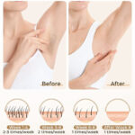 Haarlosy 3-in-1 IPL Laser Hair Removal Device - Image 4