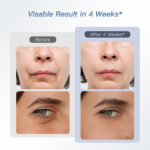 IBORRIA Skin Tightener - Image 2