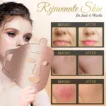 Trovoro LED Face Mask - Image 4